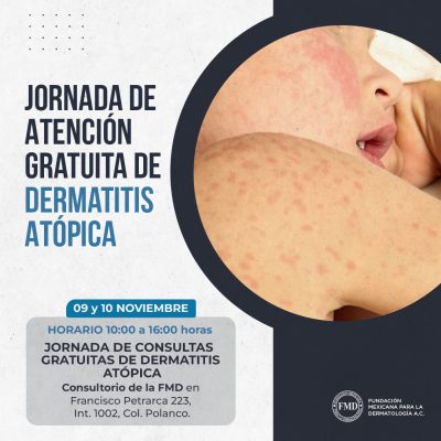 Realizarán Jornada Gratuita para Detectar Dermatitis Atópica los Días 9 y 10 de Noviembre